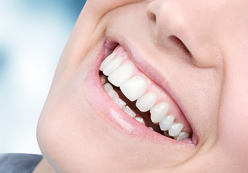 What is Tooth Bonding? Can it Work for the Front Teeth? – TruCare Dentistry