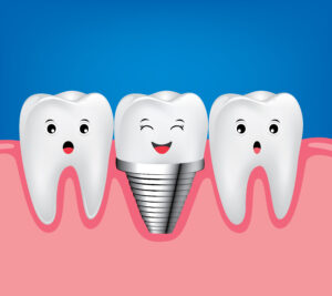 Cartoon Smiling Dental Implant
