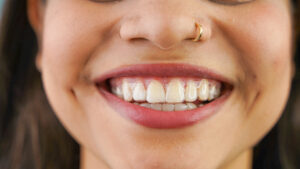 Riverside Dental Group offers Invisalign as an alternative to braces