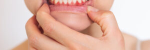 Riverside Dental Group Has Treatment Plans For Gum Disease