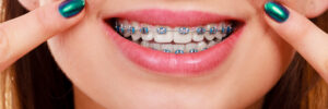 Riverside, CA, dentist offers braces or Invisalign
