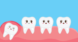 Riverside, CA, dentist offers wisdom tooth removals 