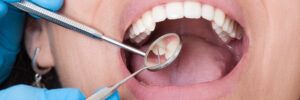 Riverside, CA, dentist offers dental cleanings and checkups