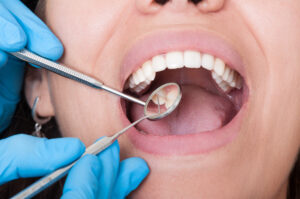 Riverside, CA, dentist offers dental cleanings and checkups