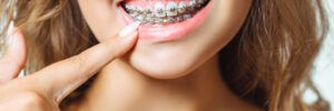 Riverside, CA, dentist offers braces and Invisalign for patients