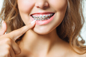 Riverside, CA, dentist offers braces and Invisalign for patients