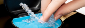 Invisalign® riverside ca