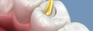riverside restorative dentistry
