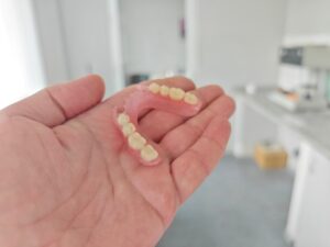 corona dentures