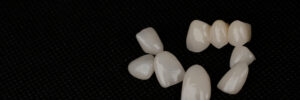 moreno valley dental crowns