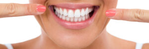 riverside teeth whitening