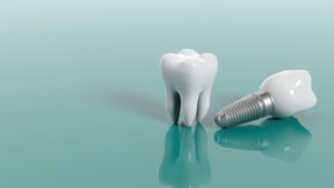 riverside dental implants