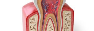 riverside root canal