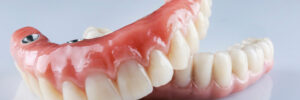 woodcrest dental prosthetic