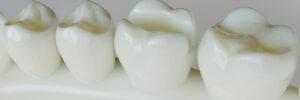 temecula restorative dentistry