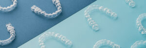 rdg corona orthodontics