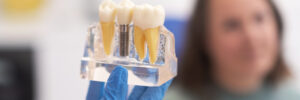 riverside dental implants