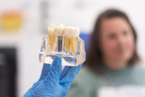 riverside dental implants