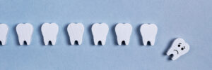 riverside root canal
