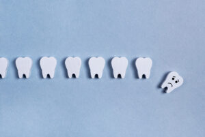 riverside root canal