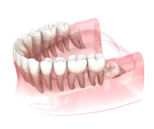 riverside wisdom teeth