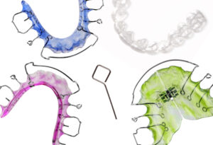 woodcrest retainer
