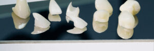 corona dental crown