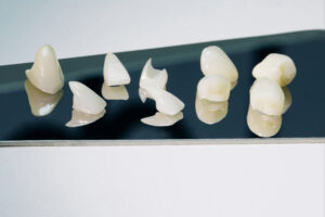 corona dental crown