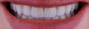 temecula restorative dentistry