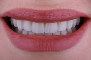 temecula restorative dentistry