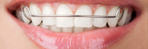moreno valley retainer