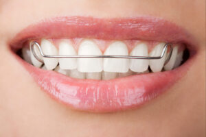 moreno valley retainer