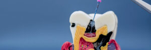 temecula endodontics