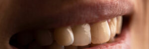moreno valley emergency dentistry