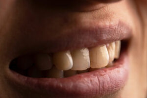 moreno valley emergency dentistry