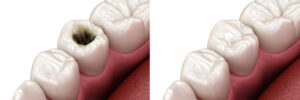 moreno valley fillings