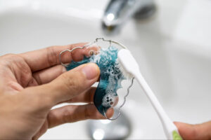 corona retainer