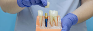 moreno valley dental implant and crown