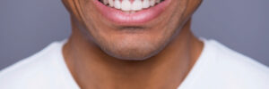 woodcrest teeth whitening