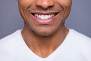 woodcrest teeth whitening